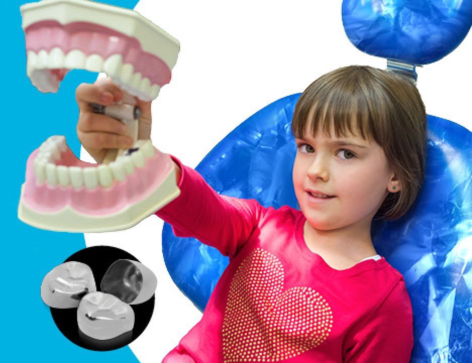 How to Talk About Pedo Crowns with Your Pediatric Patients