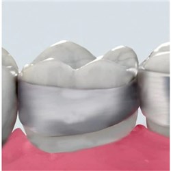 3M Victory Series First Molar Bands, 952-164, Upper, Left, Size 32, Standard, Contoured, Regular, 1-Pack