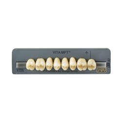 Vita MFT Upper, Posterior, Shade 3M1, Mould PU29