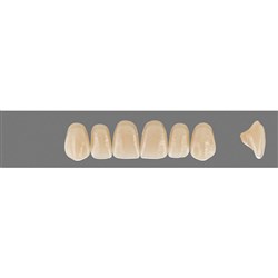 Vita MFT Upper, Anterior, Classical Shade A1, Mould R45