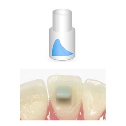 NAOL Mini-Mold Bite Ramp 3mm, 8-Pack