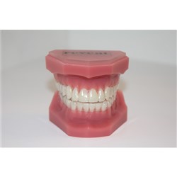 Reveal Aligners Typodont