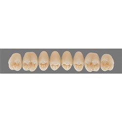 Vita Lingoform Upper, Posterior, Shade A1, Mould 24L