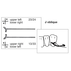 Scheu J Oblique Clasp - 0.8mm, 10-Pack