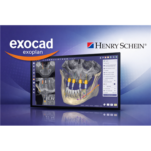 E1-BD100011IF01 - Exocad 1 Exoplan with Guide Creator Flex