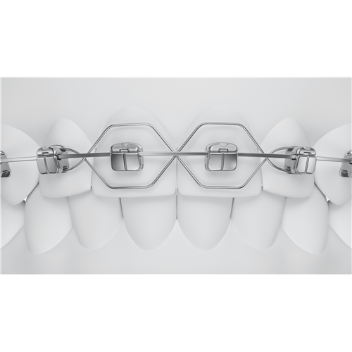 O2-102-04U27_4