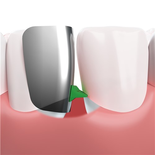 TeethCutaway