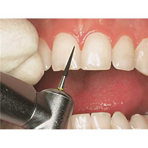 TH135Q314014X5 - Tungsten Carbide Bur KOMET #H135Q-014 Q Finisher FG x 5