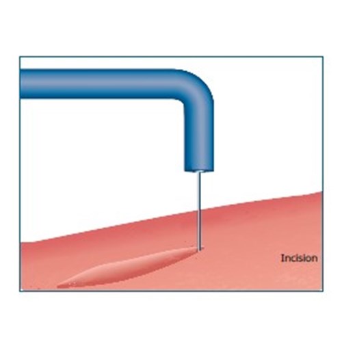 electrosection