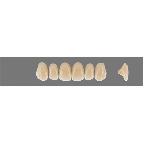 3R25 A3.5 Upper O40 Anterior