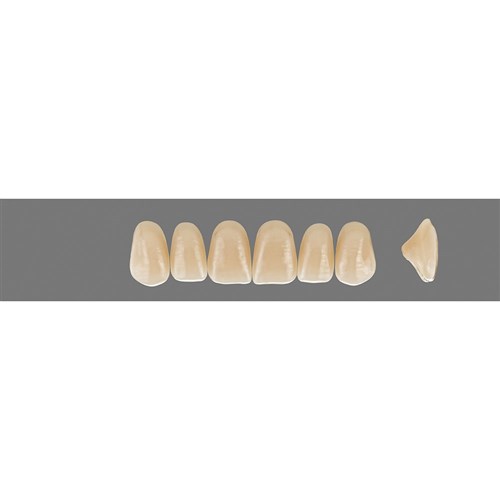 3R25 A3.5 Upper T41 Anterior