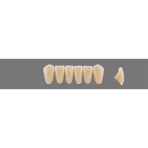 4M2 A4 Lower L34 Anterior