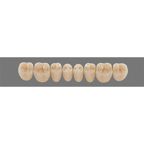 4M2 Lower PL31 Posterior