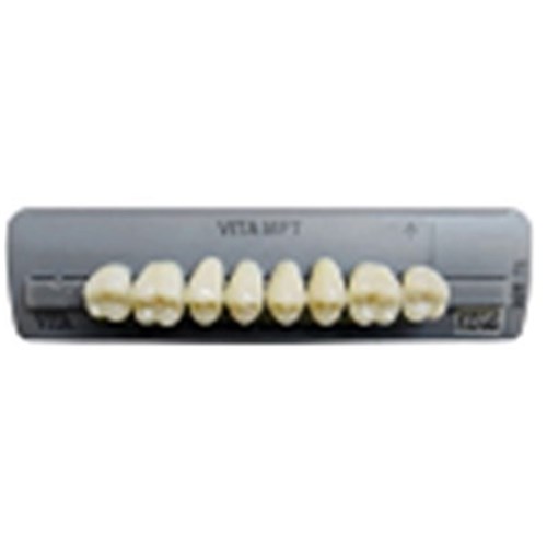 4M2 Lower PL33 Posterior