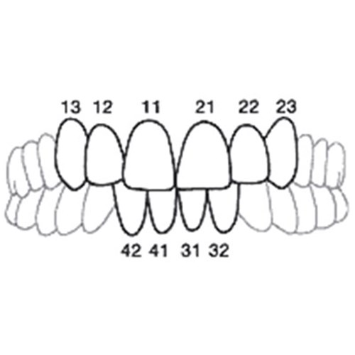 Directa CoForm - Pre-Formed Transparent Celluloid Matrices - 11M , 8-Pack