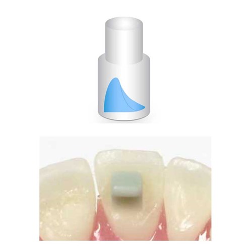 NAOL Mini-Mold Bite Ramp 5mm, 8-Pack