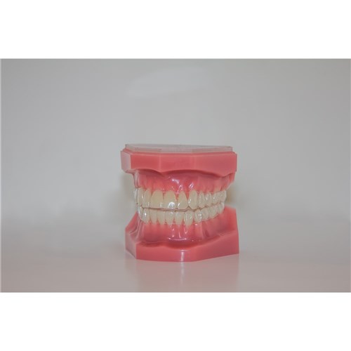 Reveal Aligners Typodont