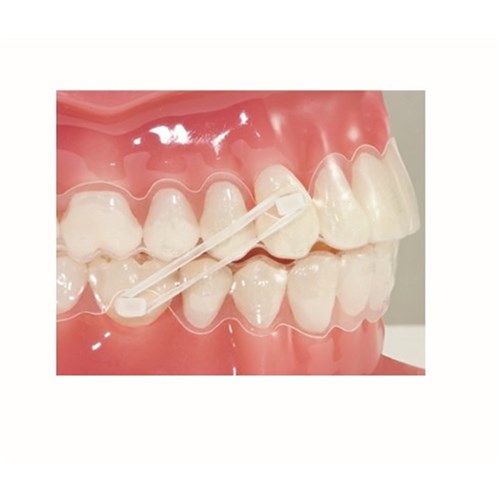 Ortho Flex Rectangular Composite Buttons, 10-Pack