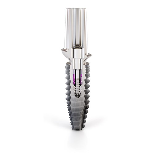 CONELOG PROGRESSIVE-LINE Implant Snap-In