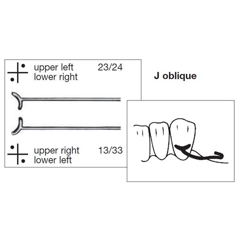 Scheu J Oblique Clasp - 0.8mm, 10-Pack