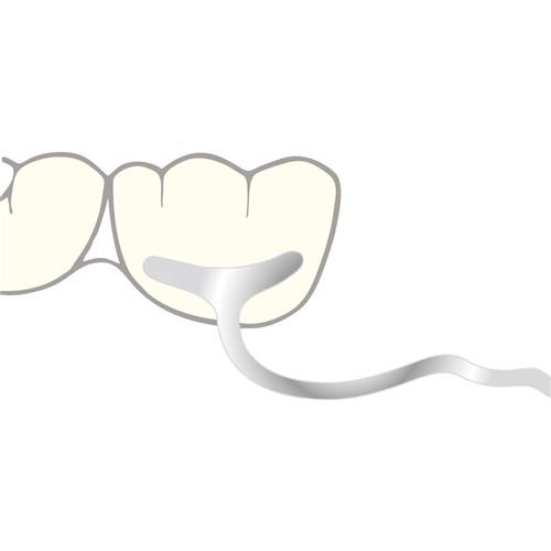 Scheu JM Clasp for Molars - 1.2mm, 10-Pack