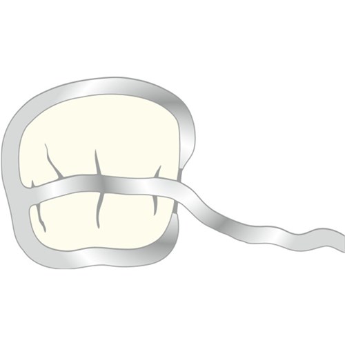 Scheu T Clasp - 1.0mm, 10-Pack