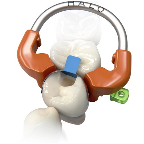 Ultradent Halo Sectional Matrix Kit - Original Bands