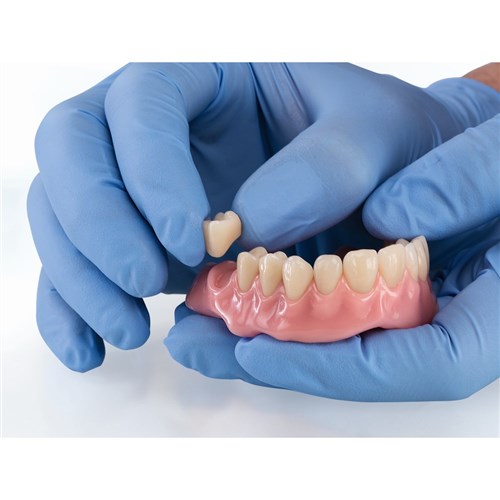 Vita VIONIC VIGO - Posterior - Shade A1, Mould 21L - UK Lower