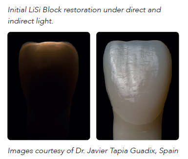 A collage of teeth restorationAI-generated content may be incorrect.